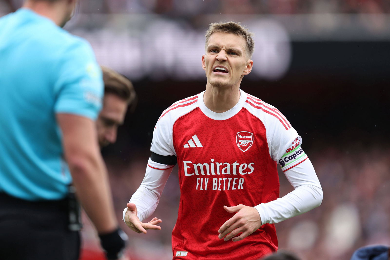 Arsenal Odegaard Injury
